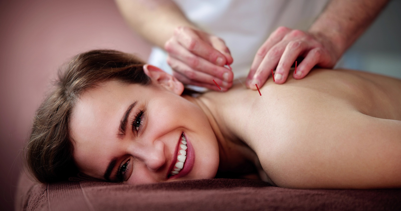 acupuncture surrey